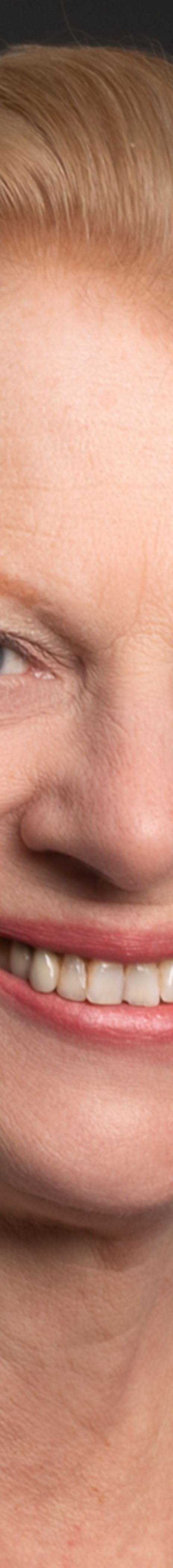 TB konferansen -  Matlary bilde